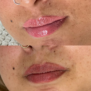 lip neutralization and colour corrections before and-after 03